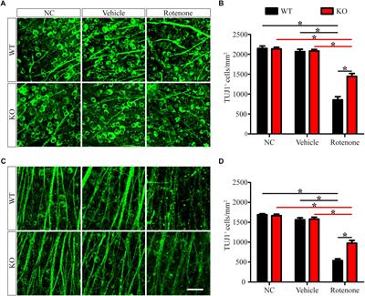 JIP1 Deficiency Protects Retinal Ganglion Cells From Apoptosis in a Rotenone-Induced Injury Model